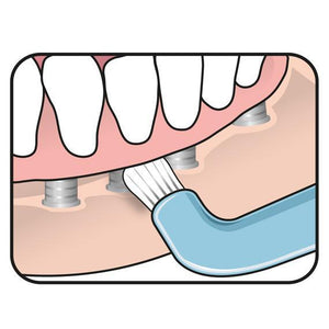 Cepillo de dientes TePe Compact Tuft ortodoncia implantes higiene dental