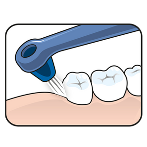 cepillo de dintes TePe Interspace Medio para implantes y ortodoncia